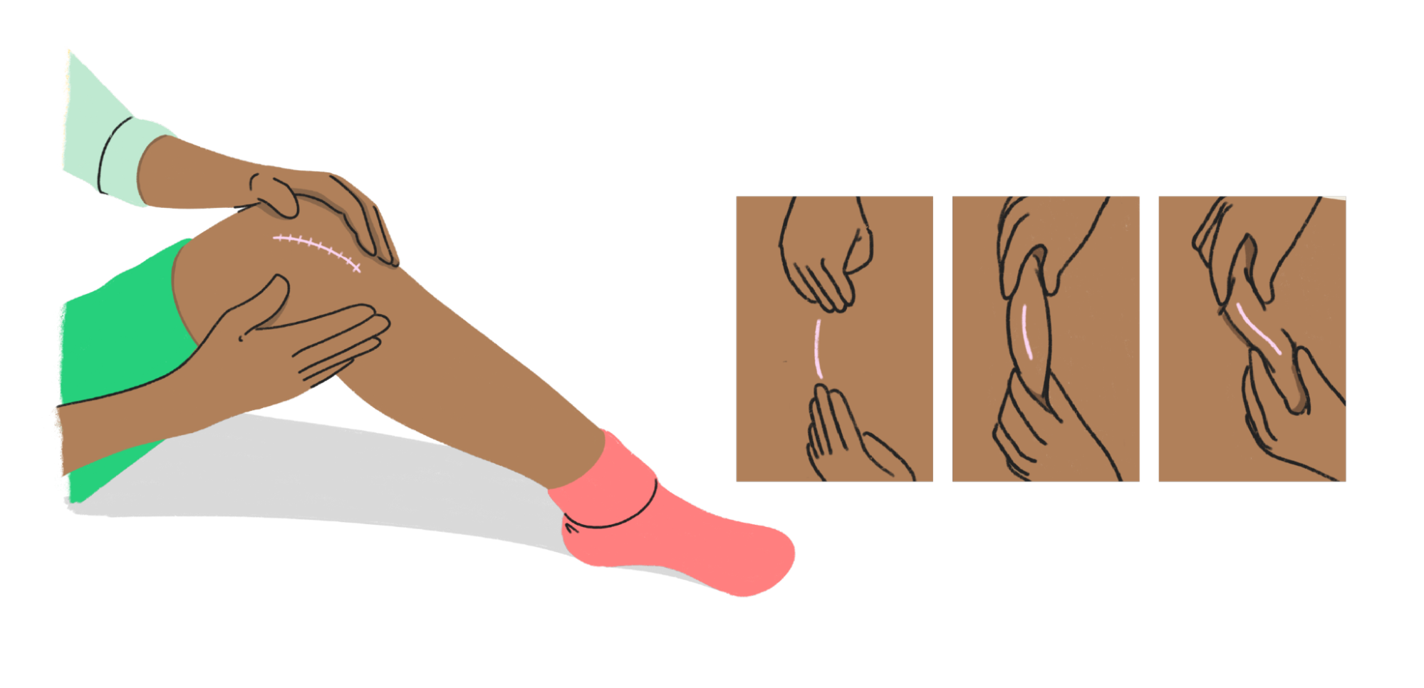 Illustration showing leg scar massage technique with three step-by-step demonstration panels on how to properly massage scar tissue