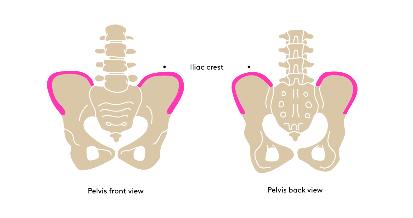 Illustration of pelvic anatomy, showing the lower portion of the spine, the sacrum, and pelvic bones, with the portion of the pelvis representing the iliac crest highlighted in pink.